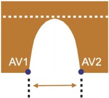 MesureAvant MesureAvant